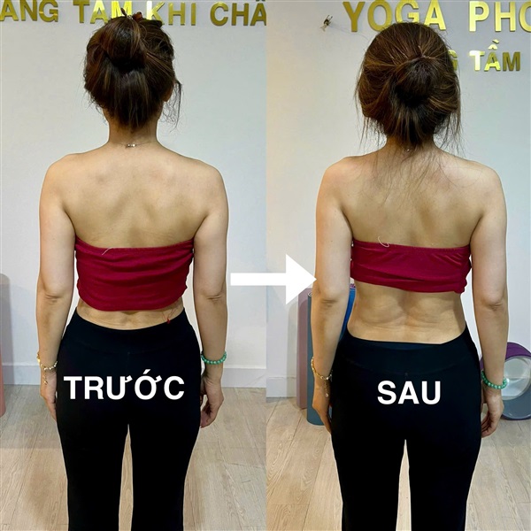 HÌNH ẢNH TRƯỚC VÀ SAU KHI CHỈNH DÁNG CÙNG BODY TALK